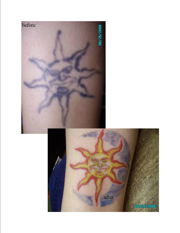 Before And After Tattoos. efore and after