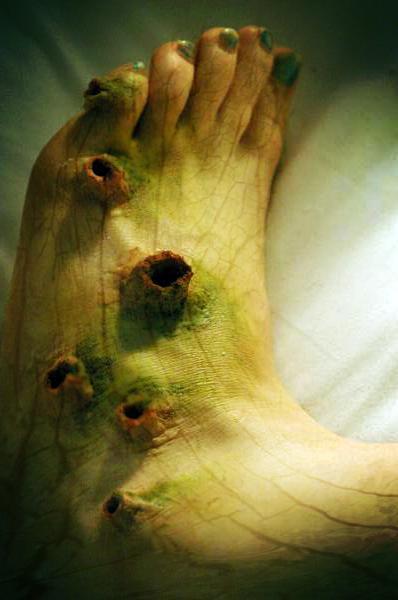Over 100 Different Types Of Fungi Found On The Human Foot